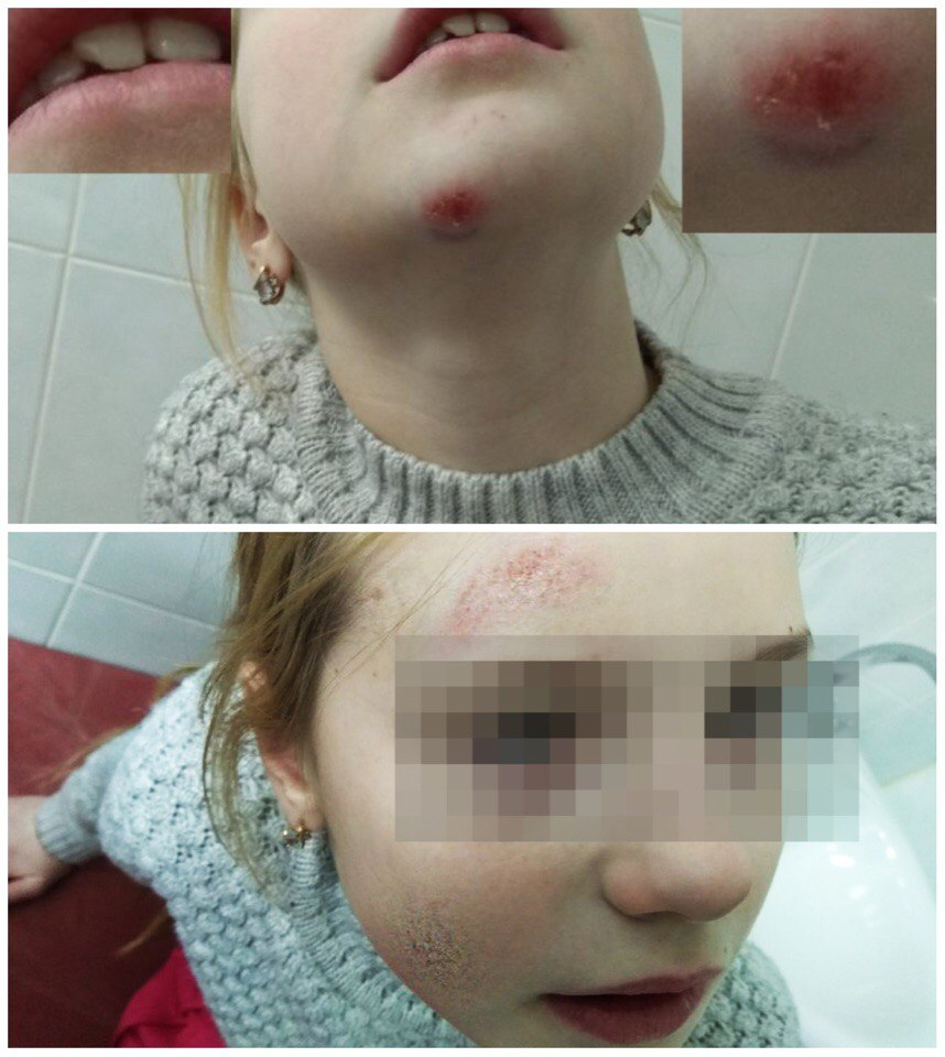 В Коми подростки избили 10-летнюю девочку и попытались её сжечь