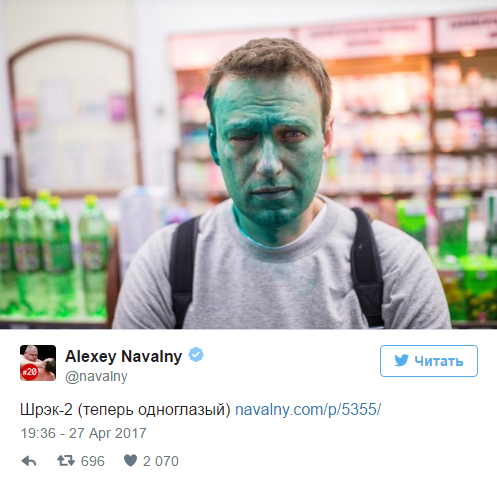 Навальный получил химический ожог глаза