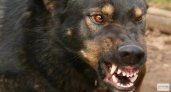 В Коми хозяйке пса, который укусил 5-летнюю девочку за щеку, придется платить