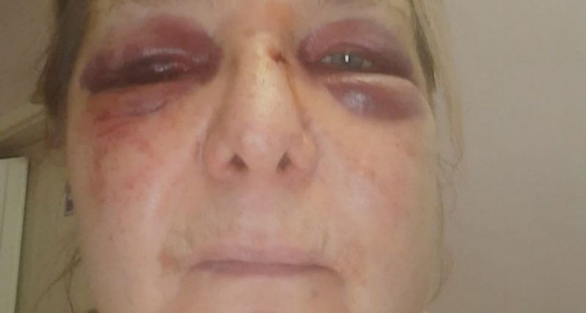 В Коми двое мужчин избили пенсионерку, которая кормила бездомных собак