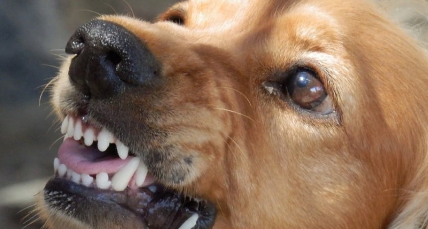 В Ухте стая собак едва не растерзала 10-летнего ребёнка 