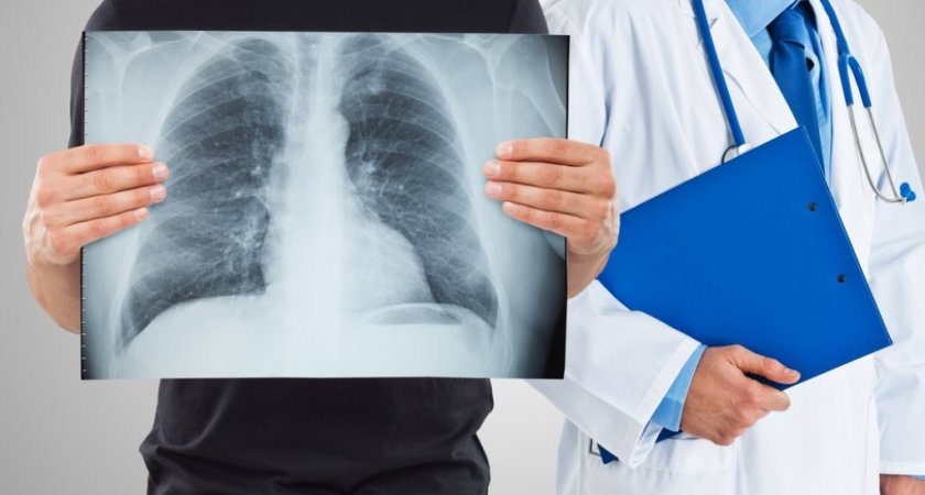 По каким признакам можно выявить рак легких?