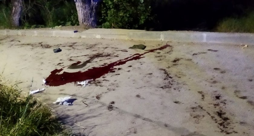 В Ухте расследуют дело о кровавом нападении на подростка в центре города