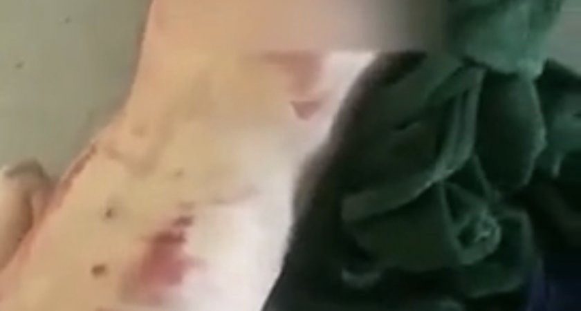 «Ужасная смерть»: ухтинец забил свою сожительницу и выкинул ее в подъезд