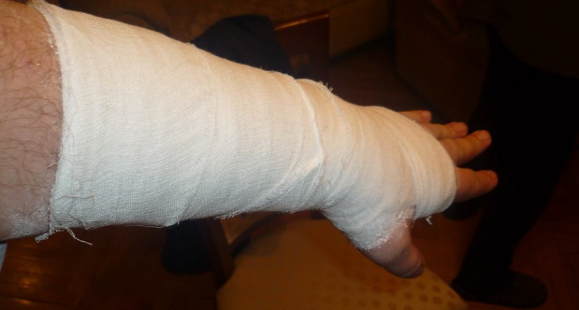 "Начала опухать рука и потемнели пальцы": Жителю Коми отказали в медицинской помощи