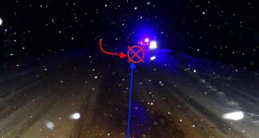 В Коми в результате лобового столкновения пострадал ребенок