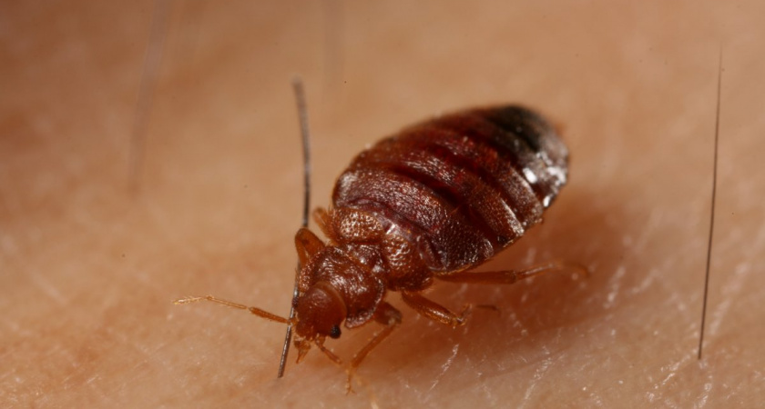 Министерство образования и науки Коми комментирует информацию об укусах клопов в лагерях