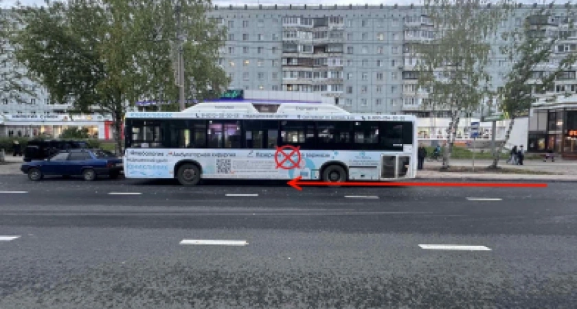 В результате резкой остановки автобуса жительница столицы Коми получила черепно-мозговую травму