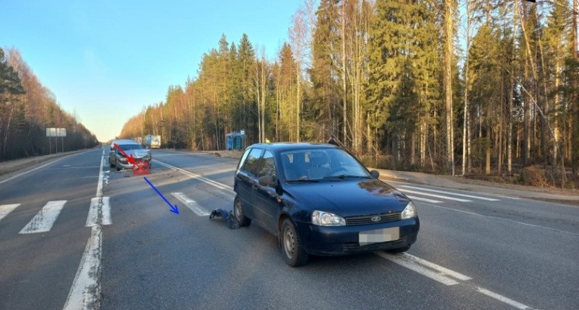 Девятилетняя девочка пострадала в ДТП на трассе в Коми