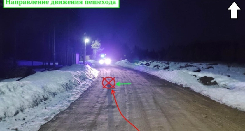 Фото к статье: Подросток на мопеде сбил ребенка в Коми