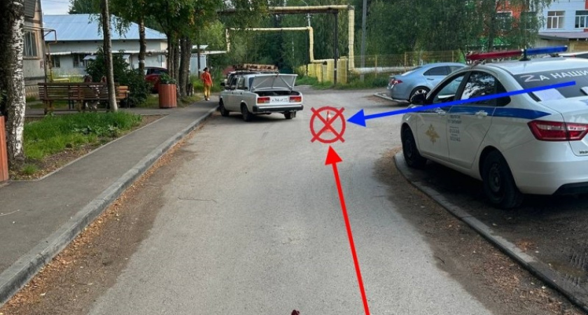 В столице Коми автомобиль сбил девочку на электросамокате