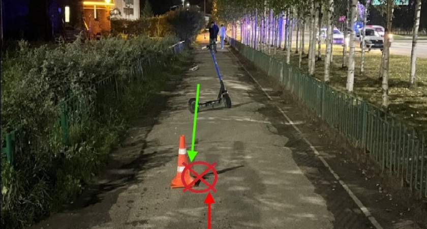 В Ухте подросток на электросамокате сбил пенсионерку