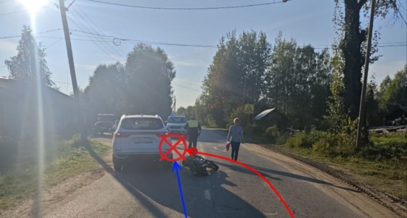 В Коми пьяный байкер попал под колеса иномарки