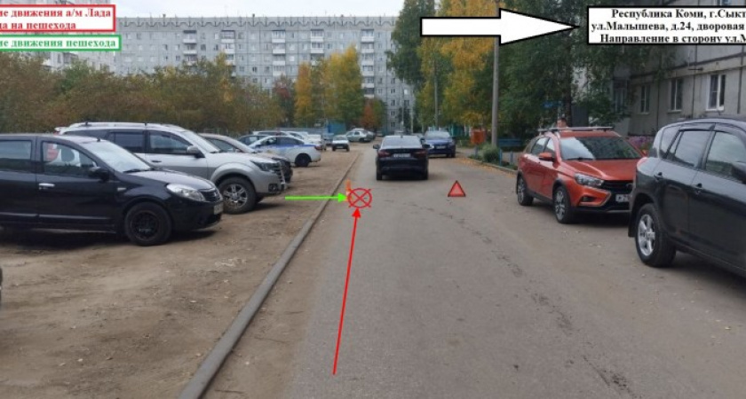 В столице Коми 6-летняя девочка попала под колеса “Лады”