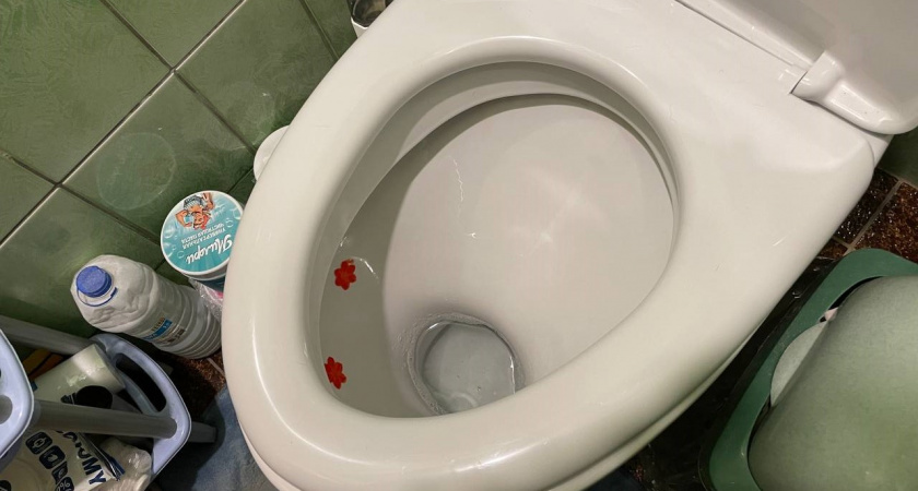Вернуть блеск унитазу без химии: простой рецепт геля от ржавчины и мочевого камня