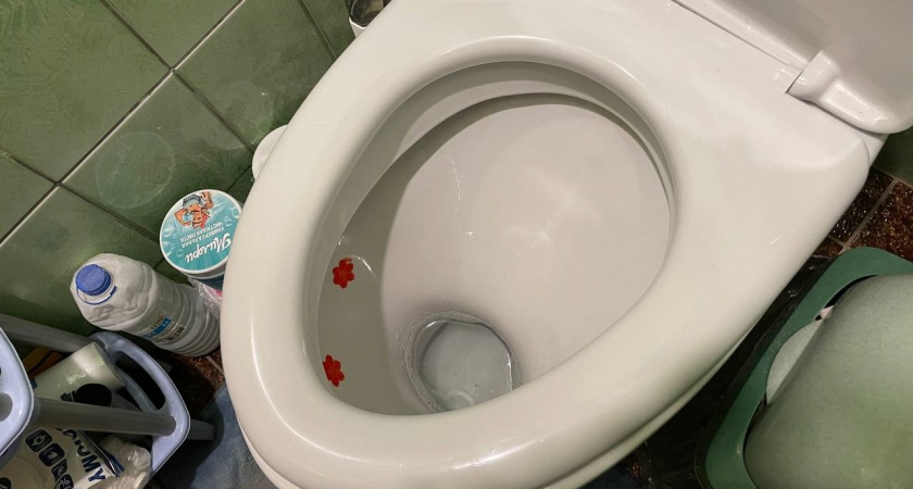 3 ложки на 2 стакана — и унитаз сияет чистотой: ни мочевого камня, ни ржавчины — лайфхак