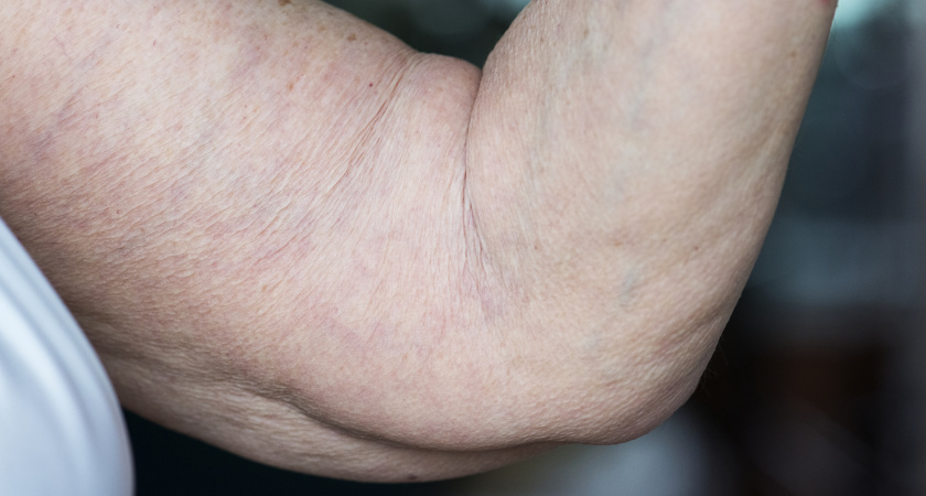 Если ваши руки превратились в дрожащий холодец, то должны знать - после 60 дело не в мышцах