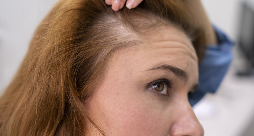 У жены волосы больше не выпадают, стали расти новые: вот что помоголо - делимся опытом.