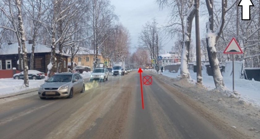 В Коми пассажирка сломала плечо в автобусе после резкой остановки