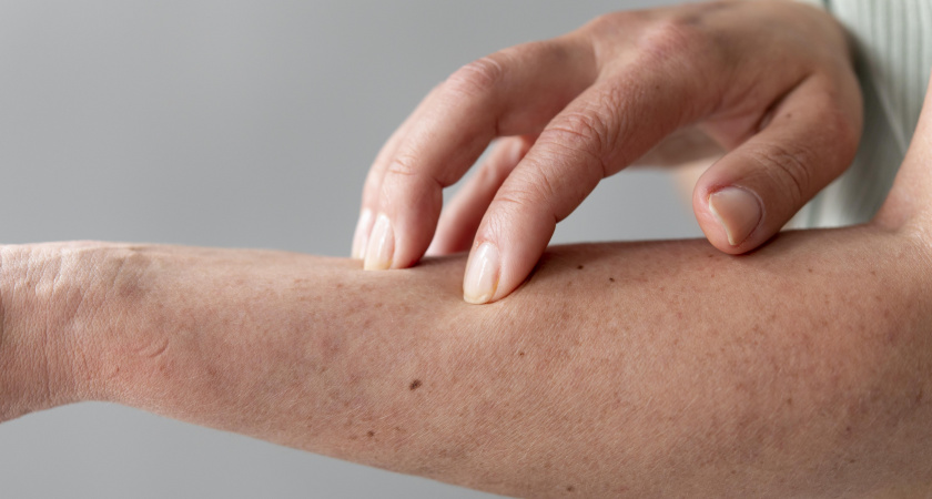 Мой способ сделать руки холеными за одну ночь - крем для рук на такое не способен, даже дорогой