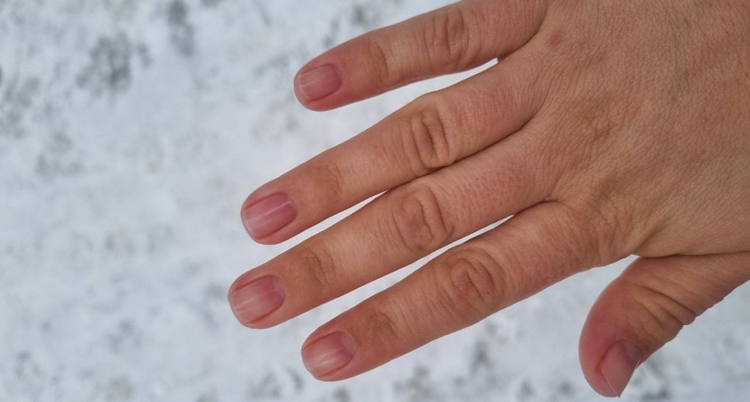 Домашняя реанимация: 5 простых шагов, которые спасут ногти после гель-лака 