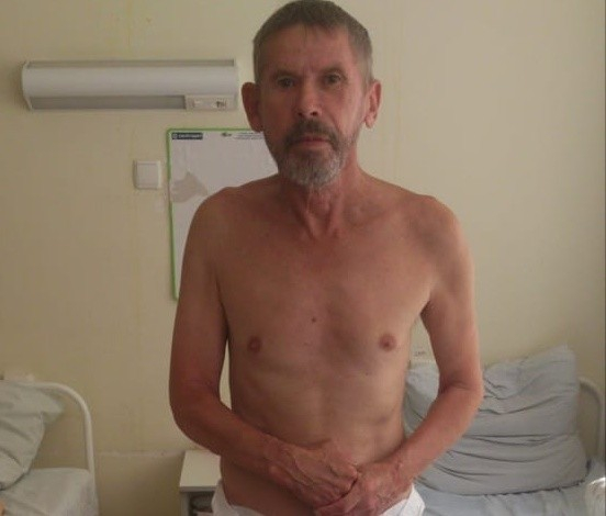 В Калуге нашли мужчину после инсульта, возможно он из Сосногорска