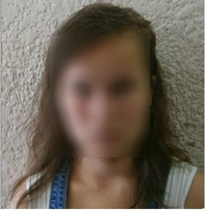 В Коми нашли пропавшую девушку-подростка со шрамом на лице