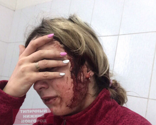 Новости России: маму с ребёнком на руках избили из-за "неправильной" парковки