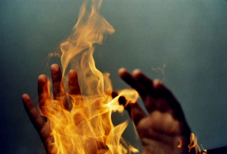В Сосногорском районе мужчина проснулся из-за горящих рук