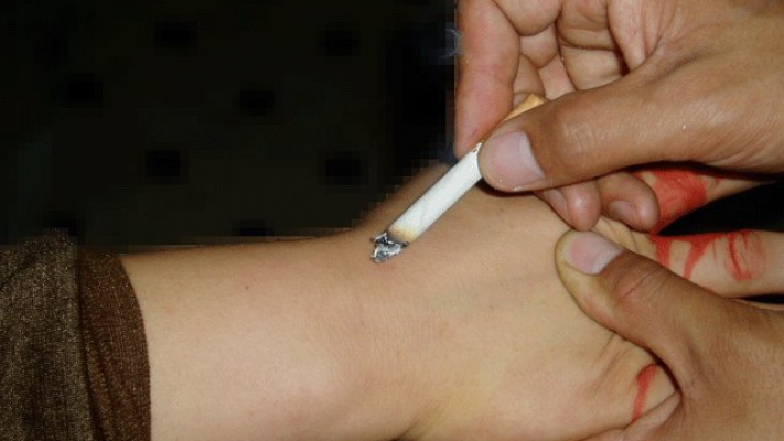В Коми подросток тушил сигареты о 8-летнего мальчика