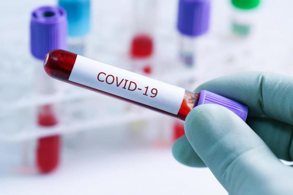 В Коми за прошедшие сутки выявлены новые случаи заболевания COVID-19