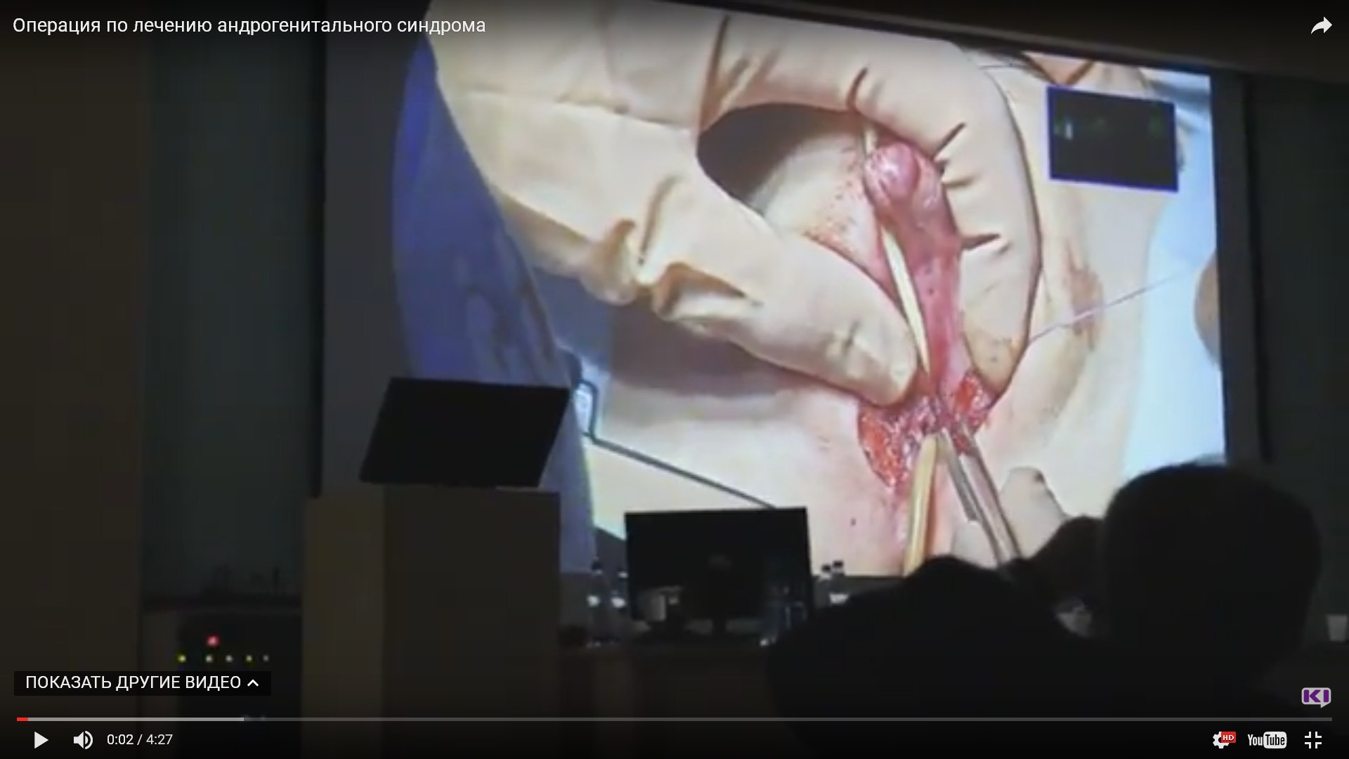 Хирург из Италии прооперировал в Коми ребенка-гермафродита