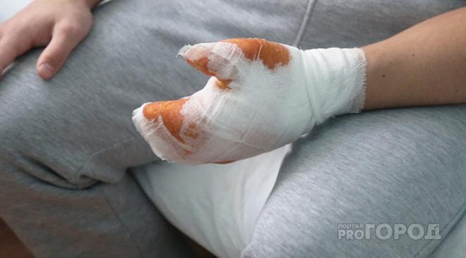 "Остался без пальцев!": в Коми в трудовом лагере произошел несчастный случай с подростком