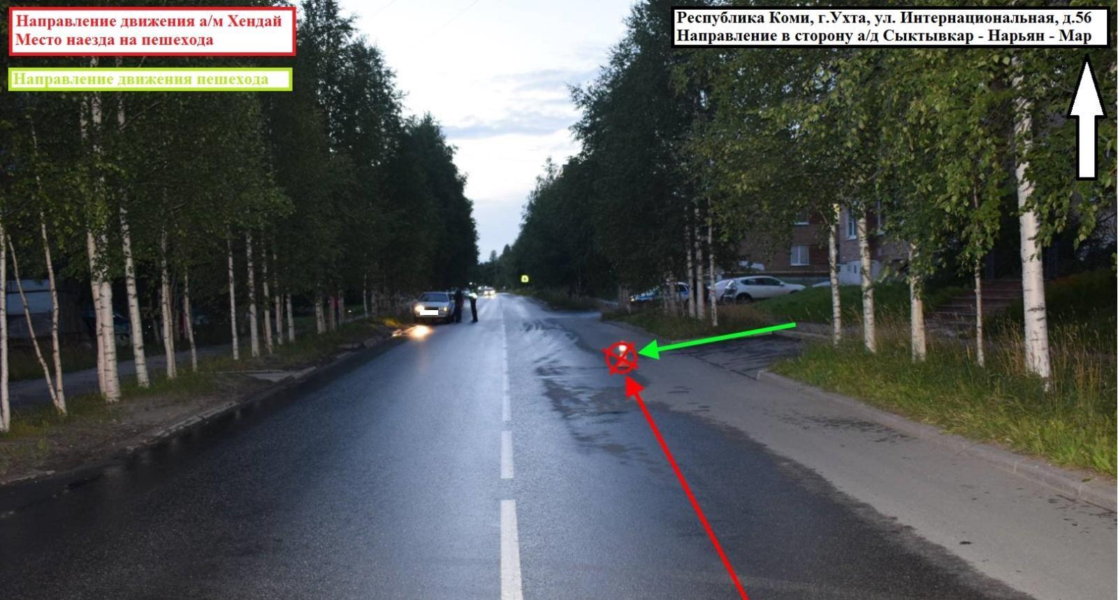 "Мальчик кричал от боли!": в Ухте ребенка сбила иномарка