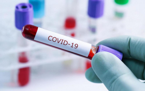 В Коми за прошедшие сутки выявлены новые случаи заболевания COVID-19