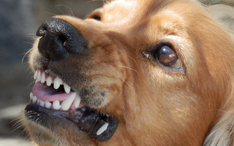"На лицо страшно смотреть из-за кровавых ран": в Коми новый случай нападения собак на ребенка