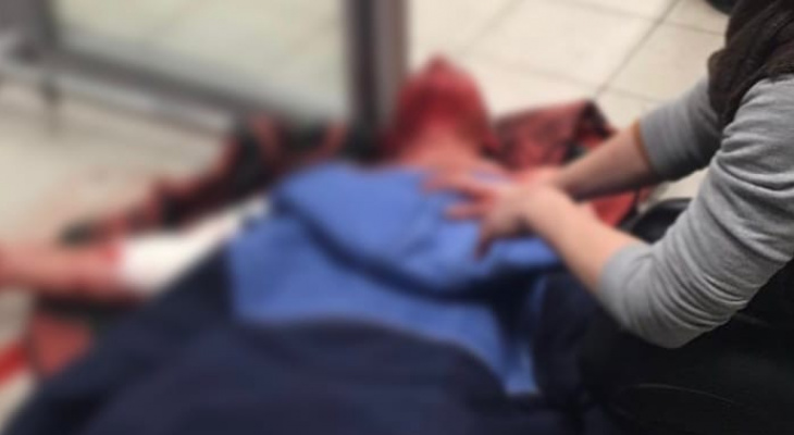 В Ухте собаки загрызли молодую женщину В Ухте собаки загрызли молодую женщину