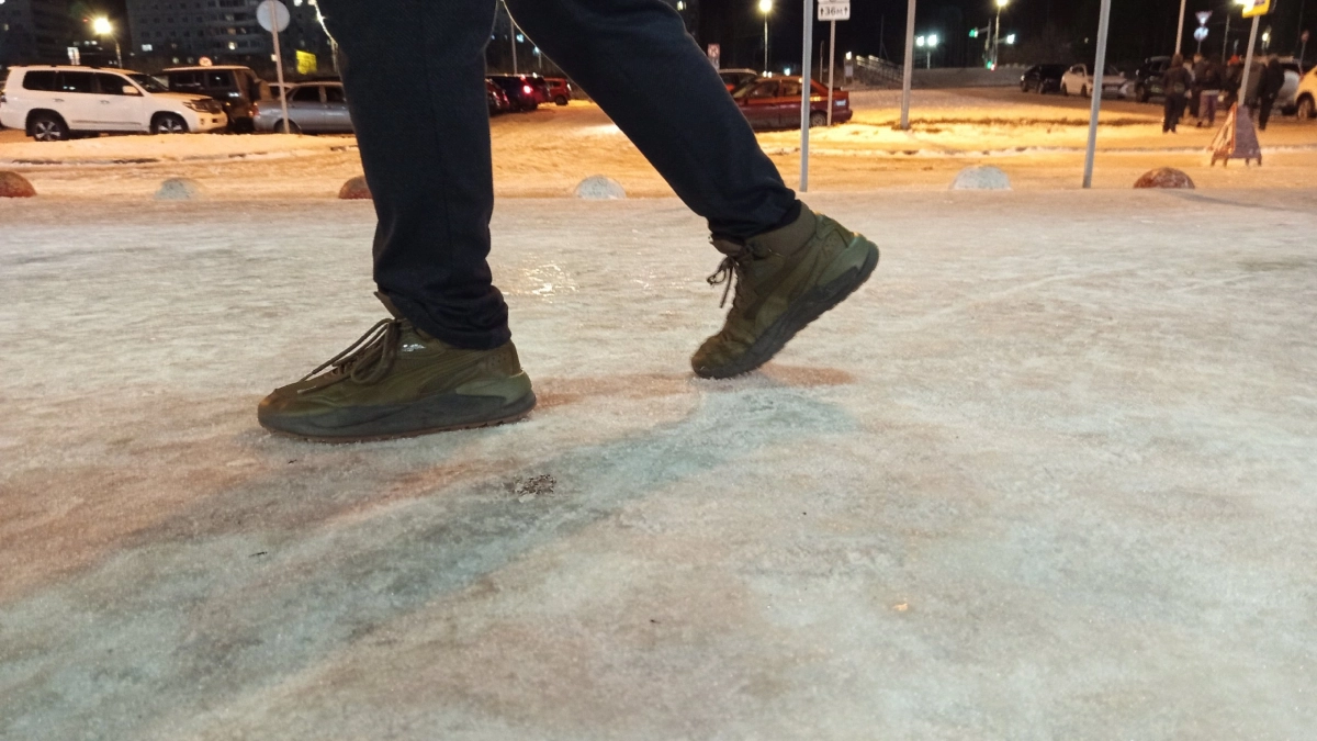 Жителям Коми рассказали, как лишний вес деформирует стопу и меняет размер обуви